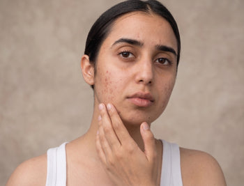 Dull Skin