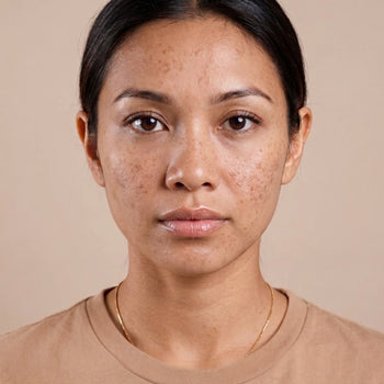 Dark Spots